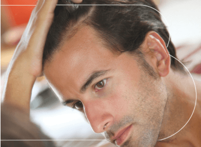 CADUTA DEI CAPELLI NEGLI UOMINI E NELLE DONNE